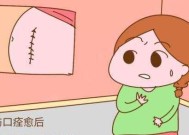 产妇看电视对恢复有什么好处？看电视的注意事项是什么？