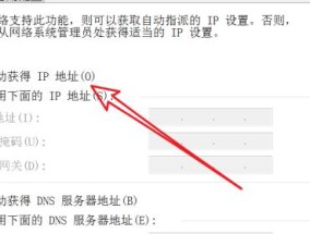 如何设置电脑的IP地址（简单步骤帮助你配置电脑IP地址）